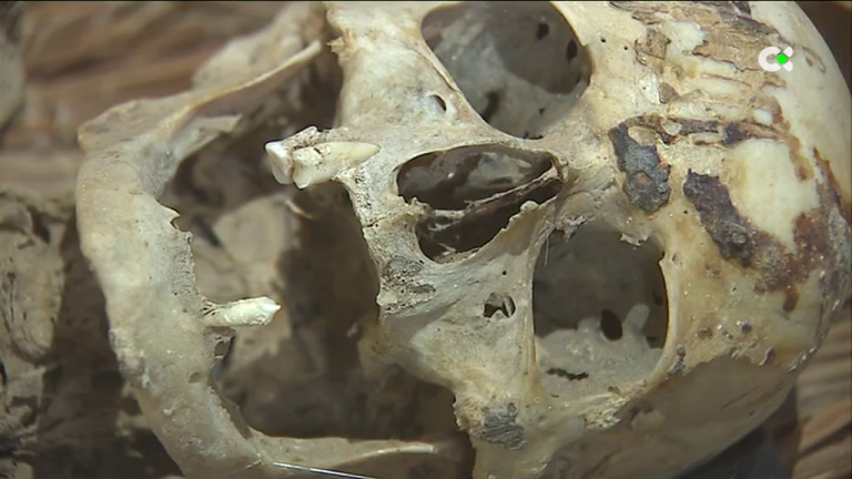 Caries, enfermedades periodontales, pérdidas dentales; así era la salud bucodental de los aborígenes