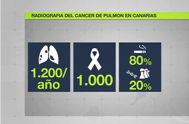 Cada año mueren 1.000 personas en Canarias debido al cáncer de pulmón