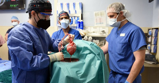Trasplantan con éxito un corazón de cerdo a un hombre en EE.UU.