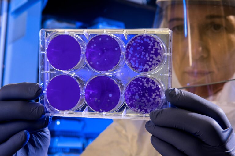Las infecciones causadas por la resistencia a antibióticos son una amenaza para la salud pública
