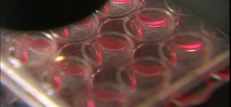 Una mujer se cura del VIH por primera vez en la historia