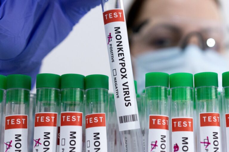 98 casos confirmados en España de la viruela del mono