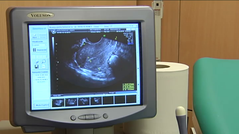 Sanidad pone en marcha un protocolo para mejorar el diagnóstico de la endometriosis