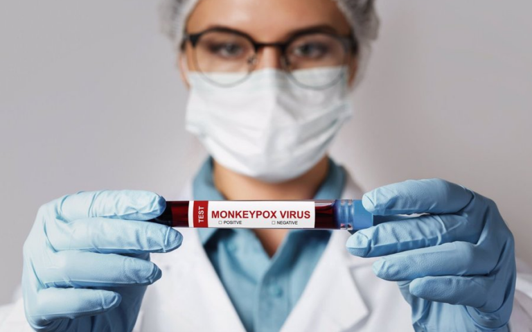Canarias no registra nuevos casos de viruela del mono desde el viernes