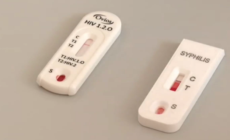 Expertos animan a utilizar las pruebas rápidas de VIH