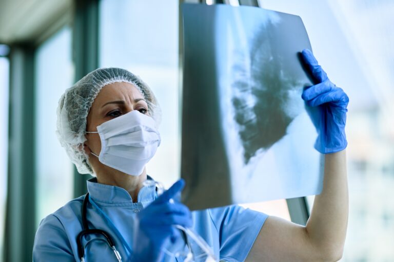 Cada vez más mujeres, más jóvenes y más no fumadores padecen cáncer de pulmón