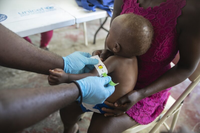 Un 30% más de niños sufre desnutrición aguda en Haití