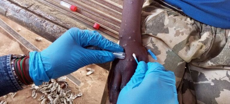 Sanidad envía a gerencias sanitarias y colegios profesionales la actualización del protocolo de detección de casos de mpox