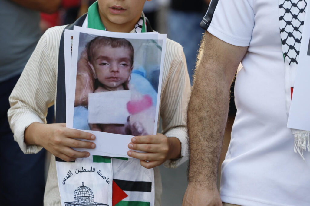 Manifestante contra el ataque de Israel en Gaza muestra la imagen de desnutrición de un niño gazatí