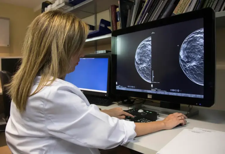 Sanidad reclama a las comunidades los datos de sus cribados de cáncer para evaluar su funcionamiento