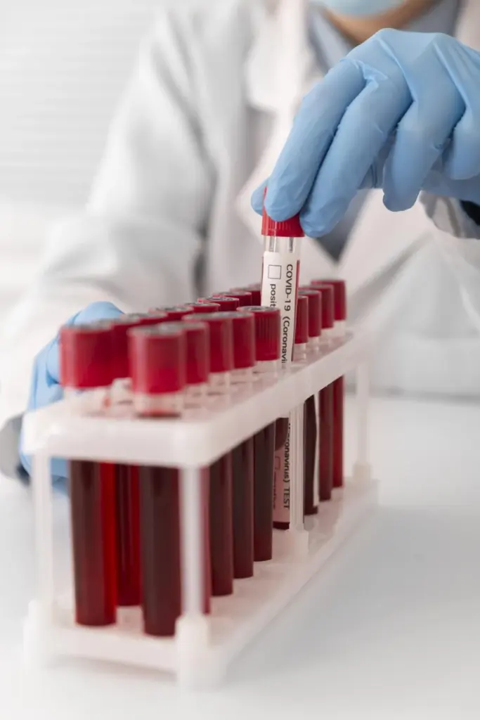 En la imagen, muestras de sangre