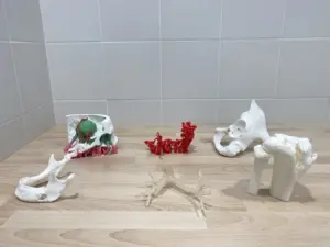 El objetivo principal es mejorar la precisión y la seguridad de los procedimientos quirúrgicos en el Doctor Negrín