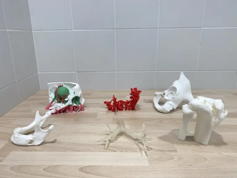 El Hospital Doctor Negrín pone en marcha una unidad destinada a integrar la tecnología 3D