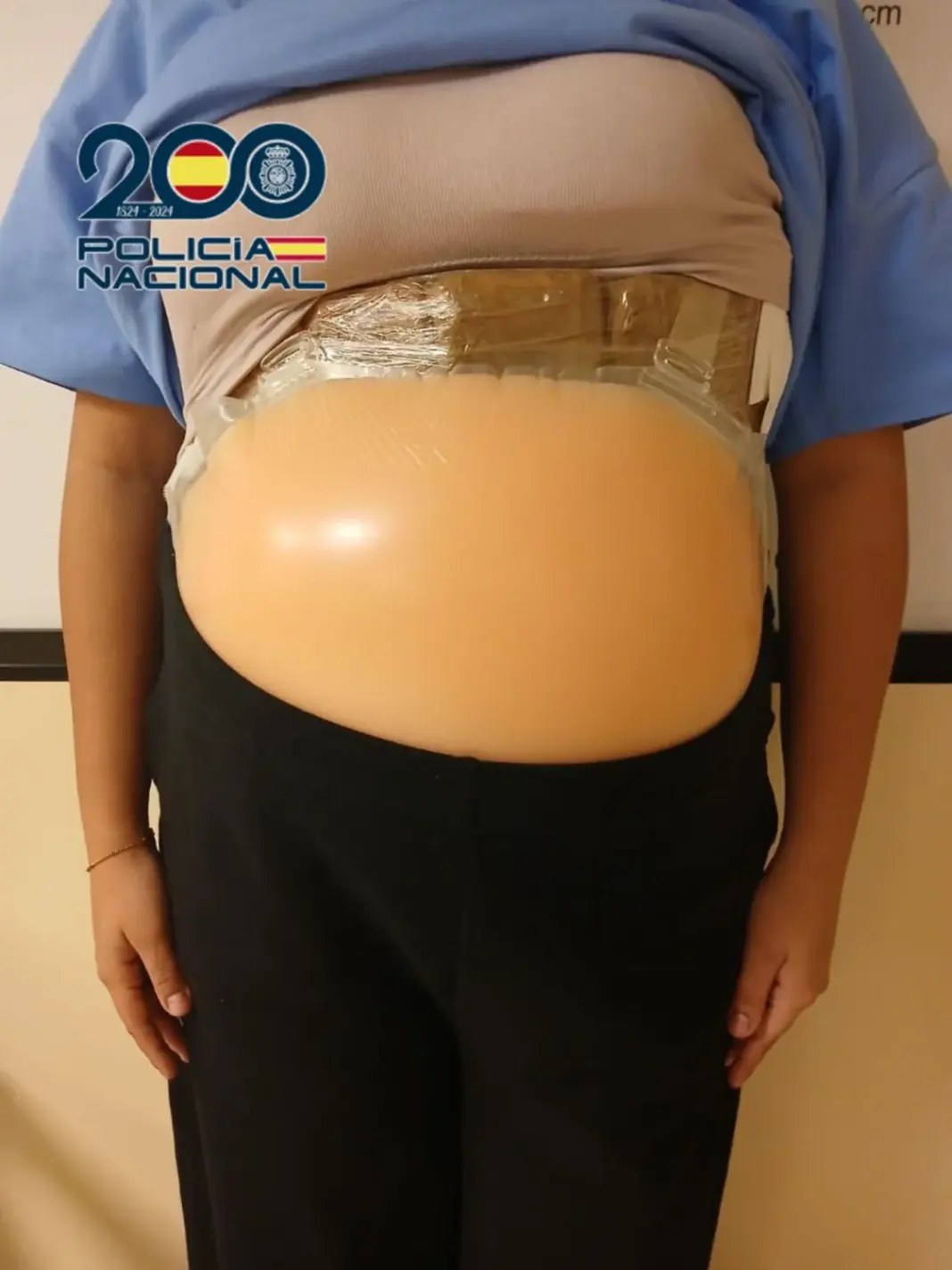 Imagen del falso vientre utilizado para ocultar la droga