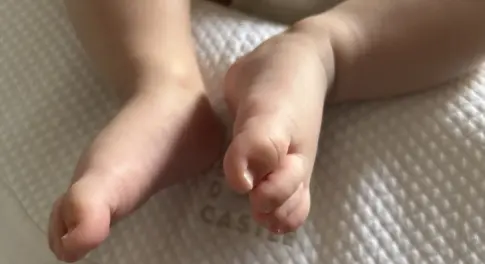 El primer nacimiento de 2026 en los hospitales públicos de Canarias, un niño en La Palma