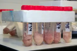 La ULPGC identifica el medregal y el mero como las especies con mayor impacto de ciguatera en Canarias